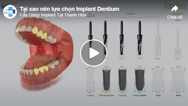 Tại Sao Lựa Chọn Cấy Ghép Implant Dentium.