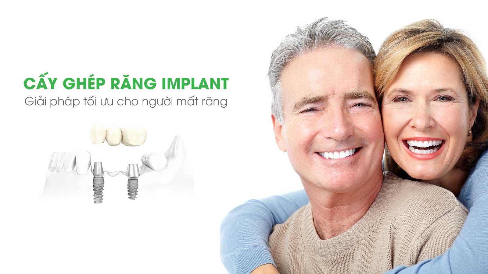 Cấy ghép răng implant ở đâu tốt tại Thanh Hóa ?
