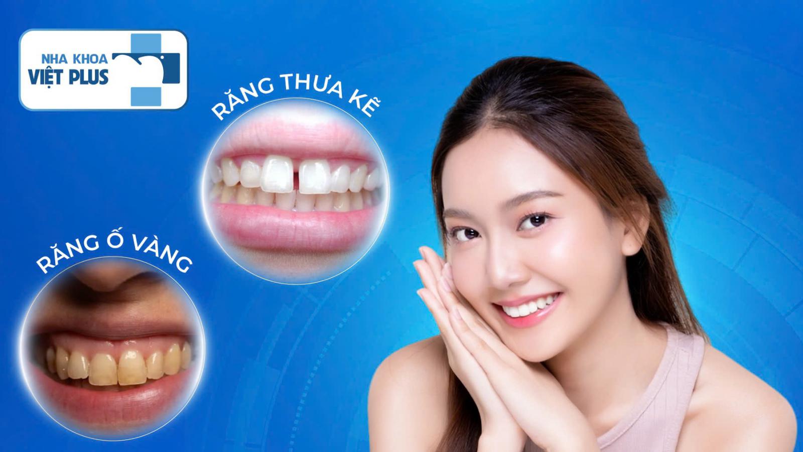 LỘT XÁC NỤ CƯỜI HOÀN MỸ CÙNG NHA KHOA VIỆT PLUS