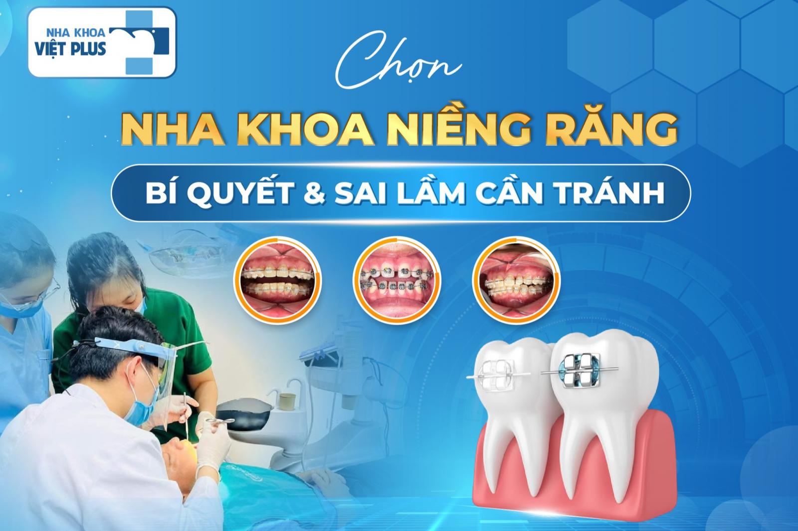 CHỌN NHA KHOA NIỀNG RĂNG - BÍ QUYẾT VÀ NHỮNG SAI LẦM CẦN TRÁNH