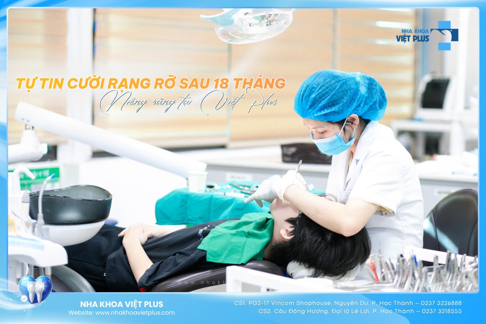 TỰ TIN CƯỜI RẠNG RỠ CHỈ SAU 18 THÁNG NIỀNG RĂNG TẠI NHA KHOA VIỆT PLUS