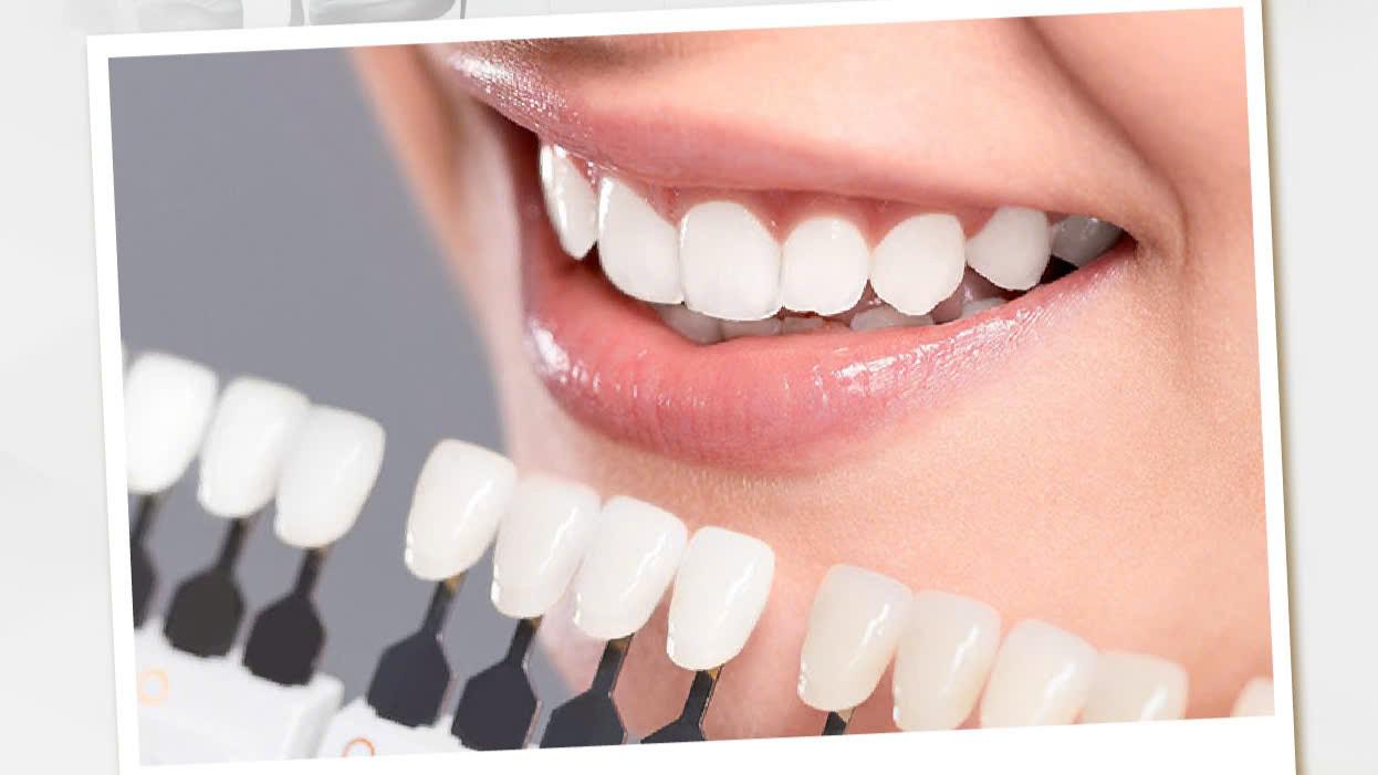 THẾ NÀO LÀ RĂNG SỨ ĐẸP?