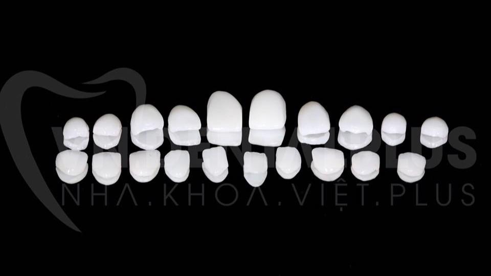 VENEER – GIẢI PHÁP MẶT DÁN SỨ THẨM MỸ