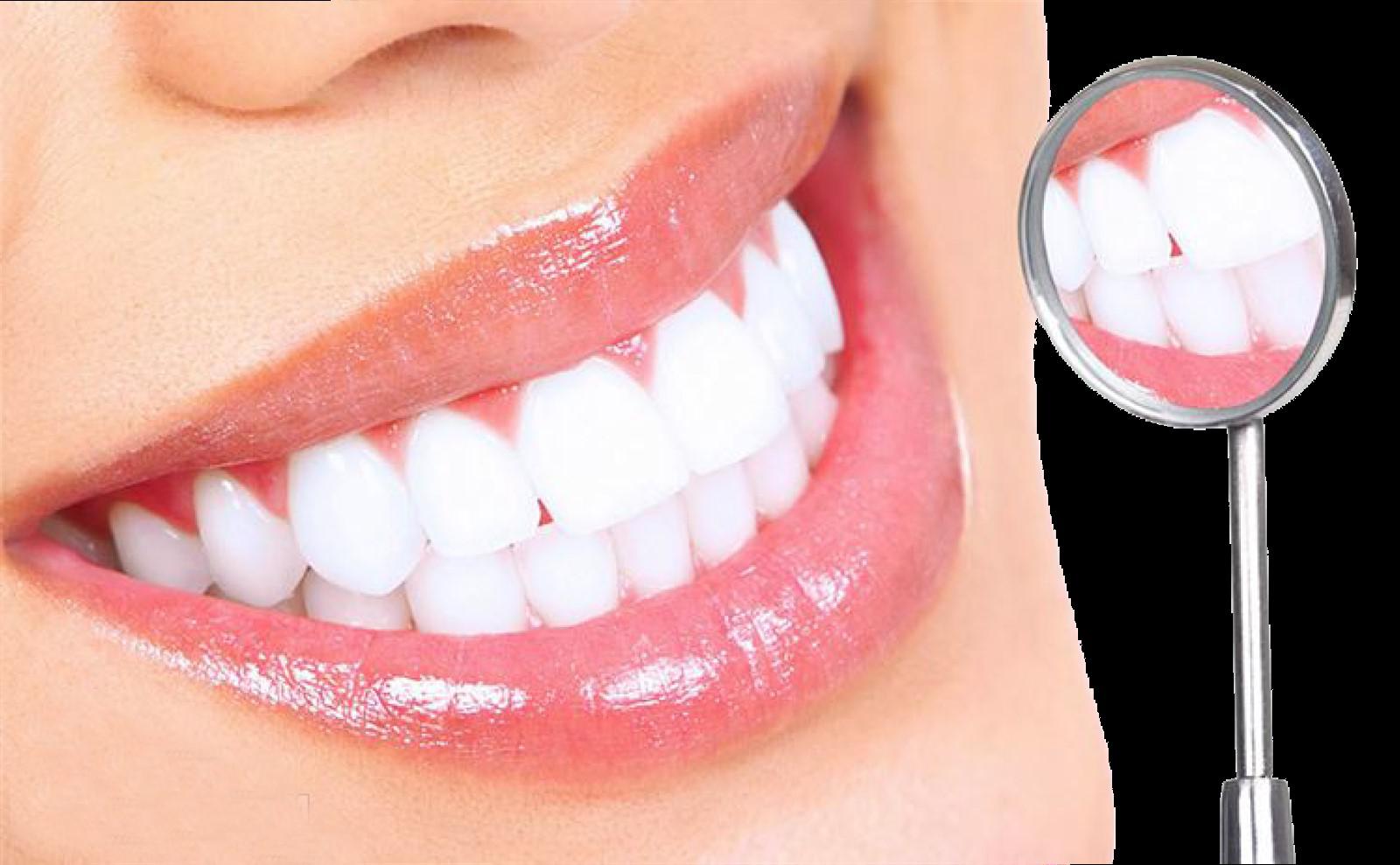 Tẩy trắng răng giá rẻ tại Thanh Hóa đảm bảo hiệu quả cao và an toàn