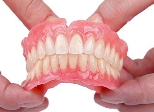 Những điều cần lưu ý khi trồng răng giả tháo lắp