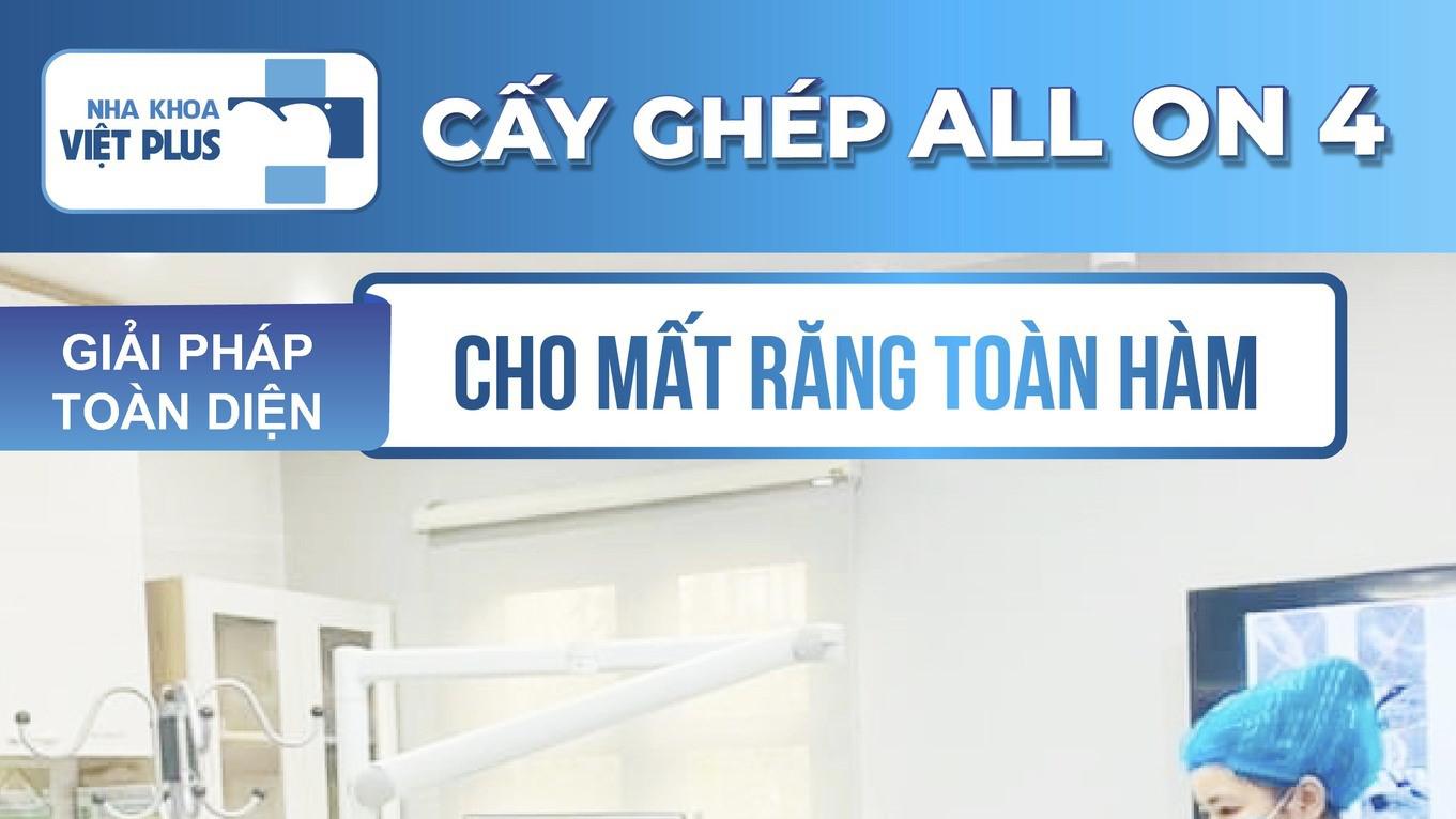 Trồng Răng Implant All On 4 – Giải Pháp Cho Người Mất Răng Toàn Hàm