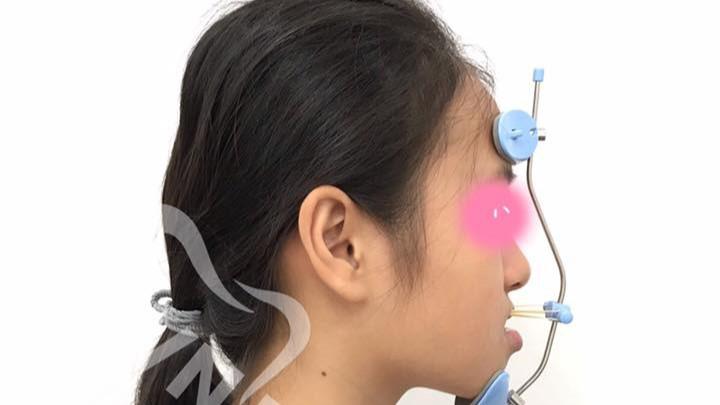 CHỈNH NHA TĂNG TRƯỞNG – KIẾN TẠO GƯƠNG MẶT HÀI HOÀ