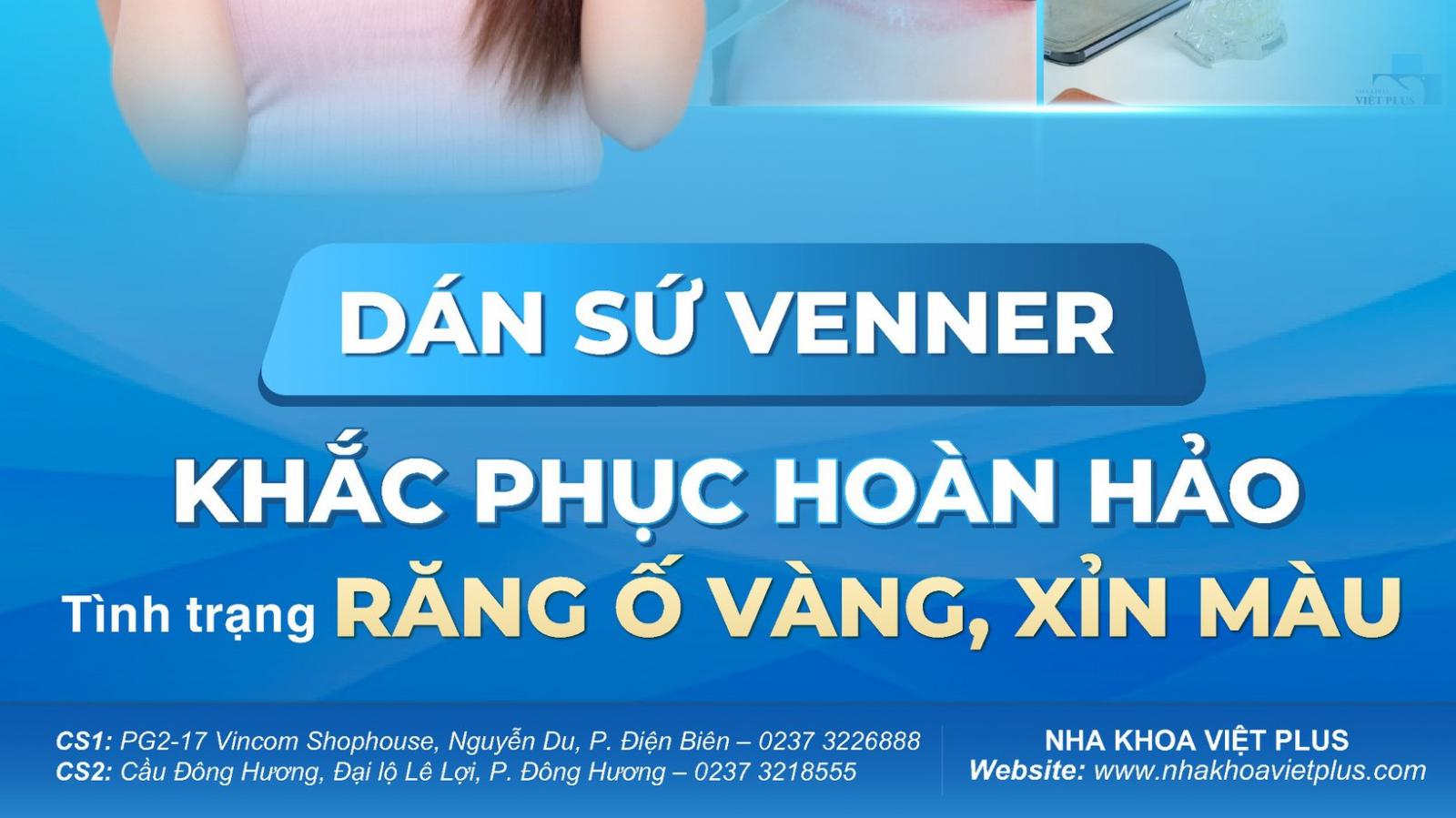 DÁN SỨ VENEER - KHẮC PHỤC HOÀN HẢO TÌNH TRẠNG RĂNG Ố VÀNG, XỈN MÀU