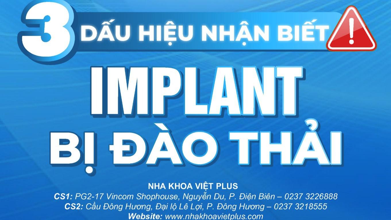 3 DẤU HIỆU NHẬN BIẾT IMPLANT BỊ ĐÀO THẢI