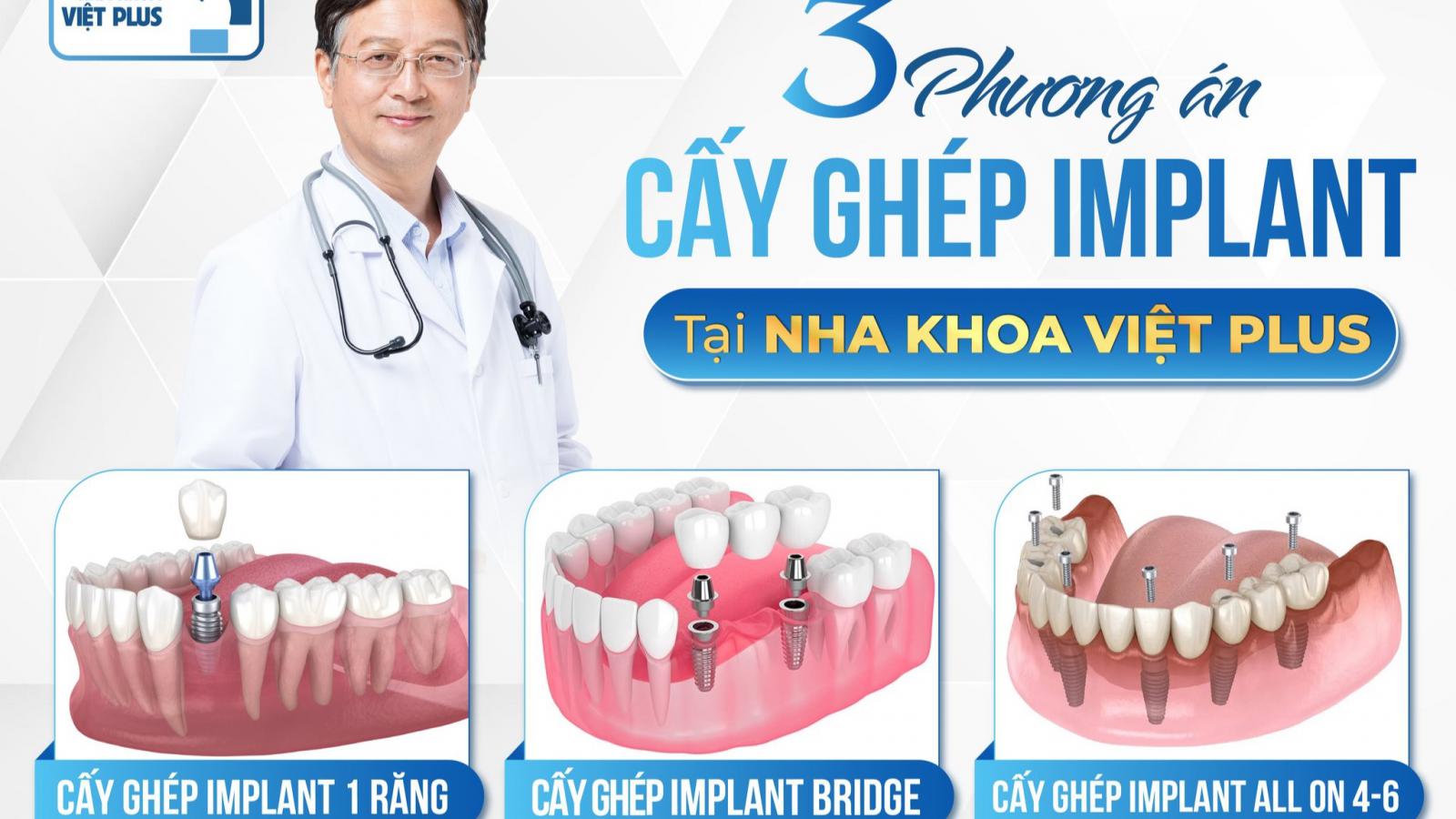 3 PHƯƠNG ÁN CẤY GHÉP IMPLANT TẠI NHA KHOA VIỆT PLUS