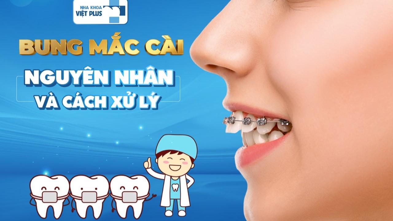 BUNG MẮC CÀI – NGUYÊN NHÂN VÀ CÁCH XỬ LÝ