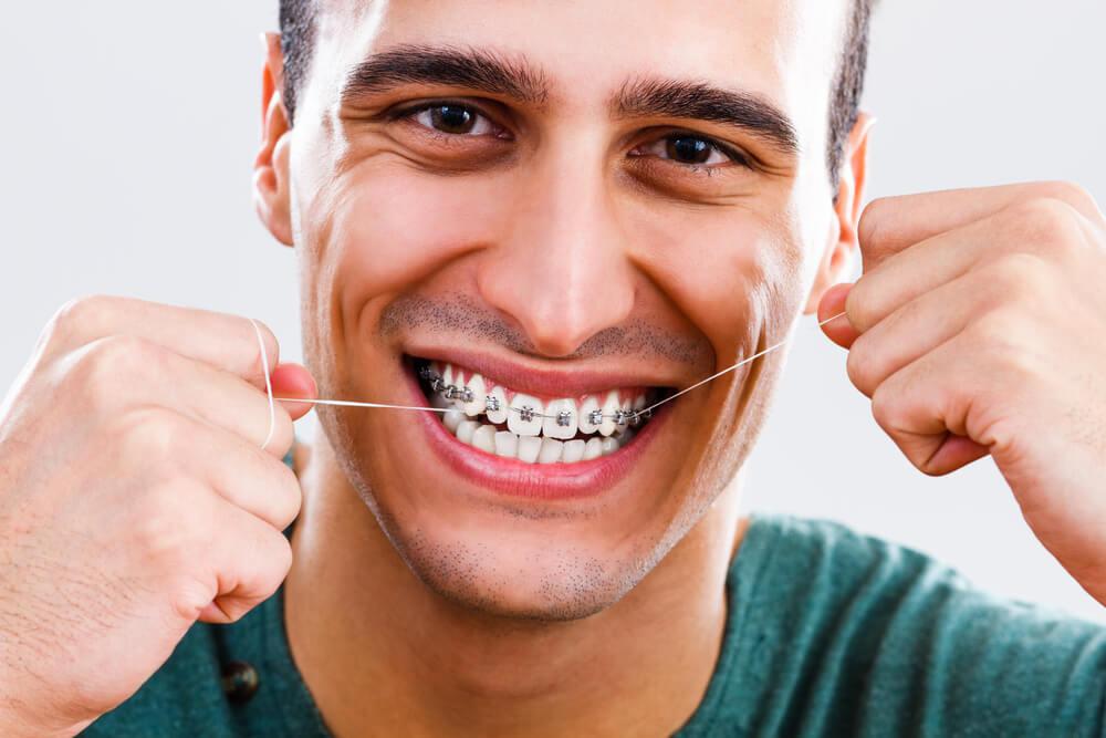 Tìm hiểu về các loại niềng răng và chi phí
