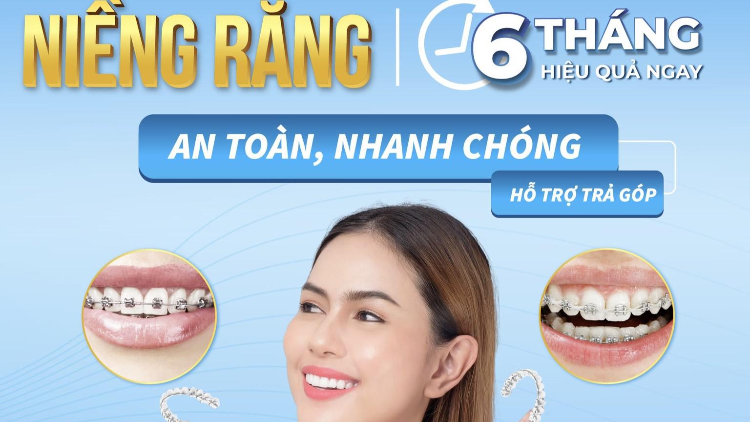 “THIẾT KẾ” NỤ CƯỜI HOÀN MỸ VỚI CHI PHÍ CỰC HỢP LÝ