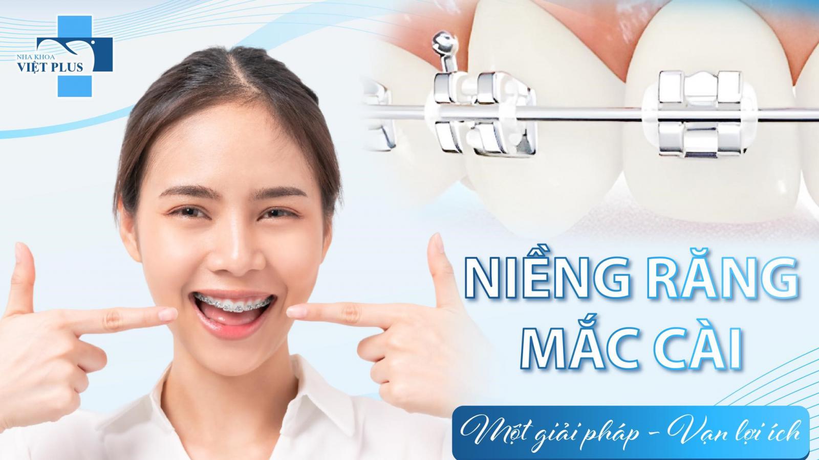NIỀNG RĂNG MẮC CÀI – TRẢ GÓP CHỈ TỪ 1.5 Triệu!