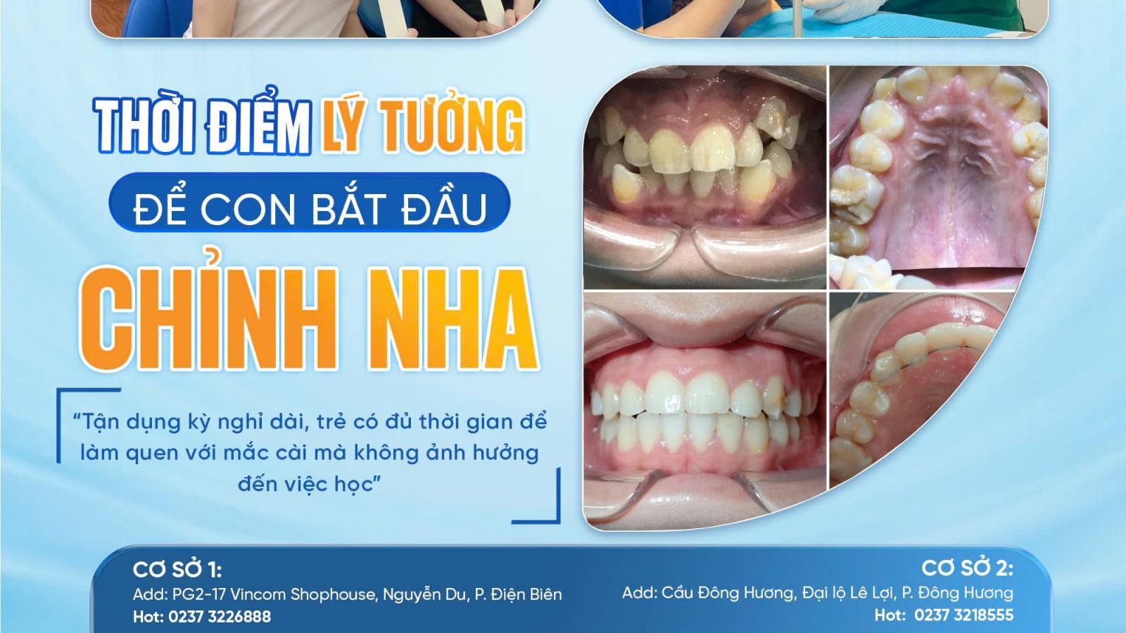 NIỀNG RĂNG MÙA HÈ - THỜI ĐIỂM VÀNG CHO CON TRẺ