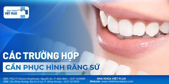 CÁC TRƯỜNG HỢP CẦN PHỤC HÌNH RĂNG SỨ