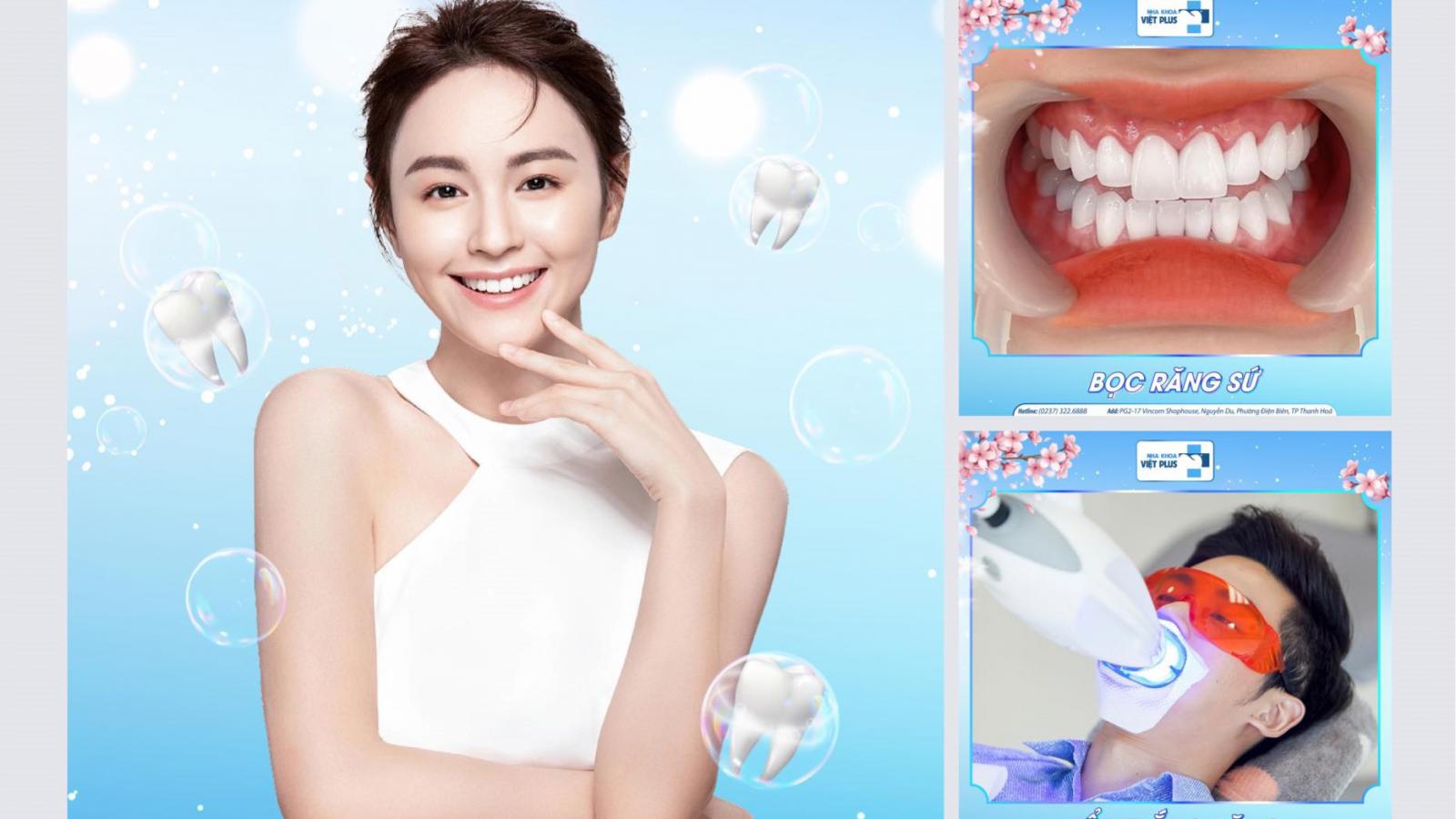 RĂNG ĐẸP NHƯ Ý, CHẲNG LO CHI PHÍ CÙNG NHA KHOA VIỆT PLUS