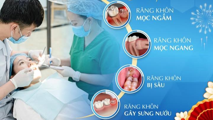 XỬ ĐẸP RĂNG KHÔN – ĐÓN LỄ “ÊM RU”