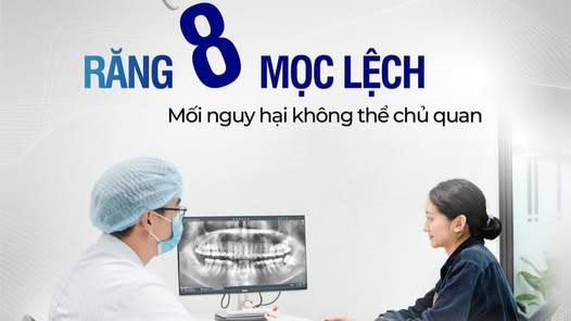 RĂNG KHÔN MỌC LỆCH – MỐI NGUY HẠI KHÔNG THỂ CHỦ QUAN