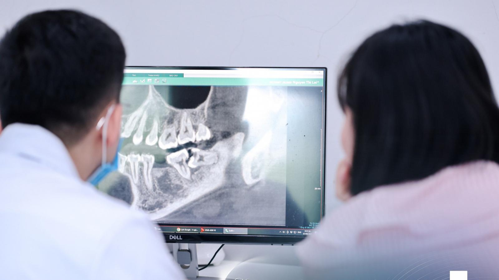 Có những thứ tồn tại không phải để giữ lại – răng khôn là một ví dụ