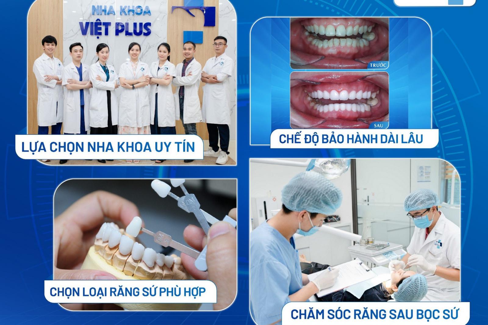 BÍ QUYẾT RĂNG SỨ BỀN, ĐẸP MÃI VỚI THỜI GIAN