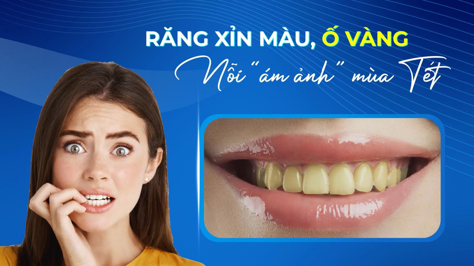 RĂNG XỈN MÀU, Ố VÀNG – NỖI “ÁM ẢNH” MÙA LỄ HỘI
